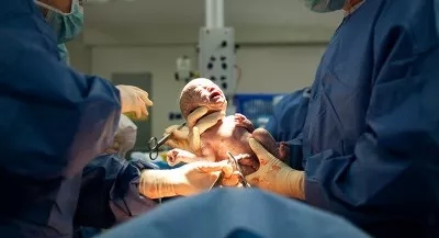 美国试管婴儿：剖腹产6小时后怎么翻身
