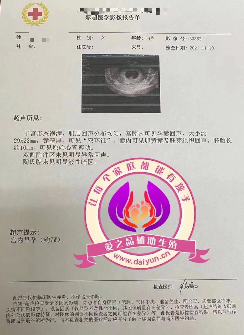 恭喜陕西西安客户志愿者成功检测到胎心