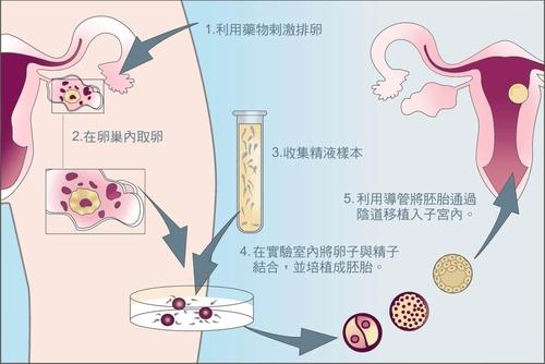 「试管」广州中医药大学第一附属医院生殖中心试管一般需要多久